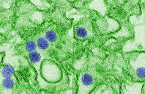 Zika virus