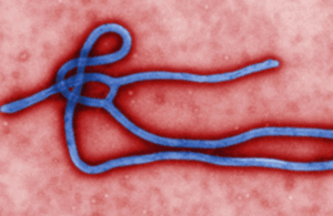 Ebola virus