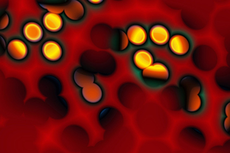 Hepatitis C virus