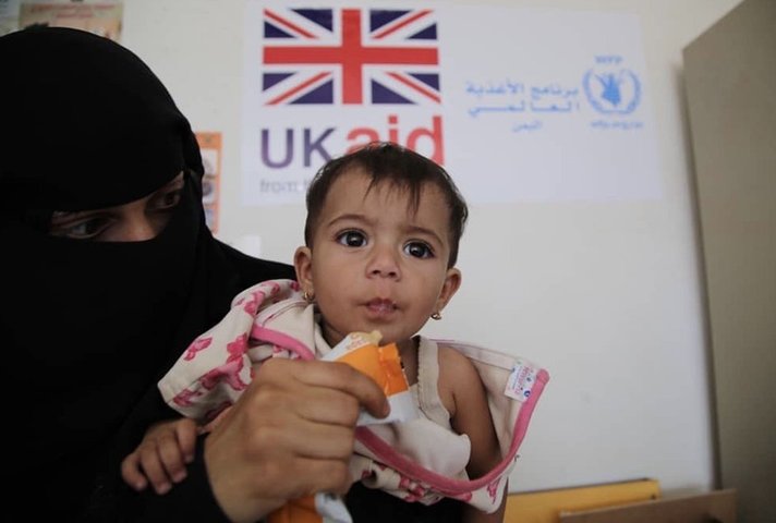 A malnourished child receives therapeutic food at a UK-supported clinic in Yemen.