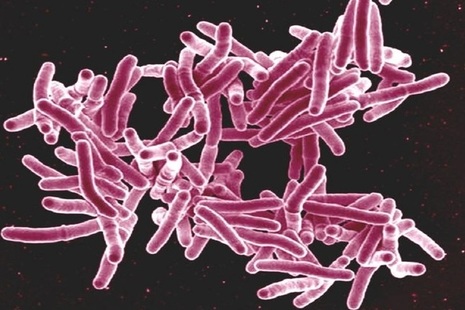 Magnification of TB genetic code