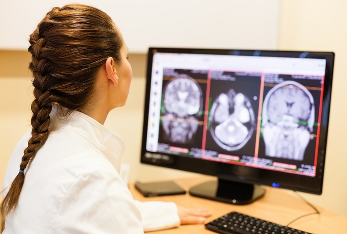 Doctor analysing MRI of brain scan