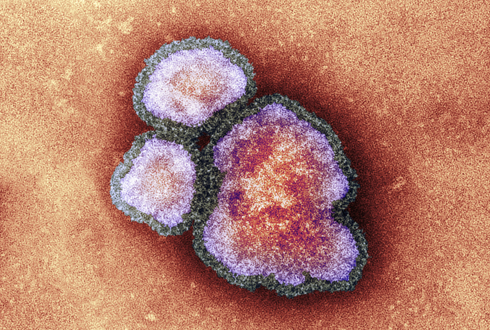 Measles pathogen