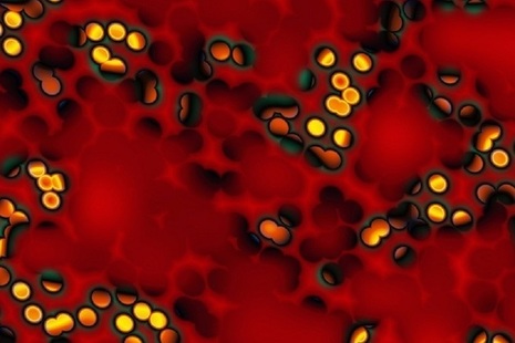 Hepatitis C infection