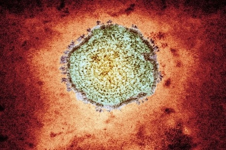 Mumps virus viewed under microscope