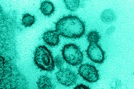 Microscope image of a coronavirus