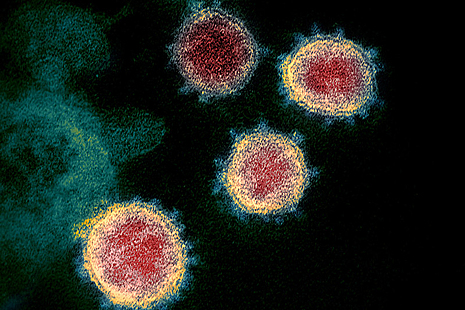 Microscope image of a coronavirus