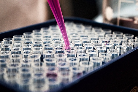 A pipette being used in a lab.