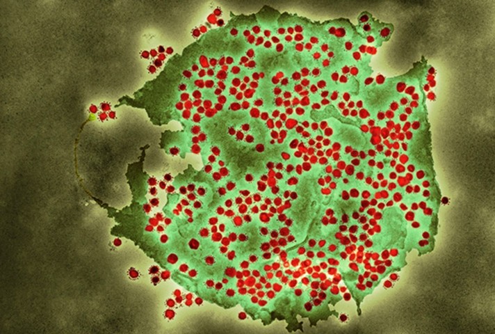 Coronavirus