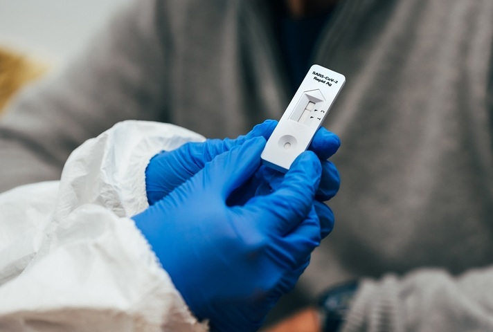 Lateral flow test for coronavirus