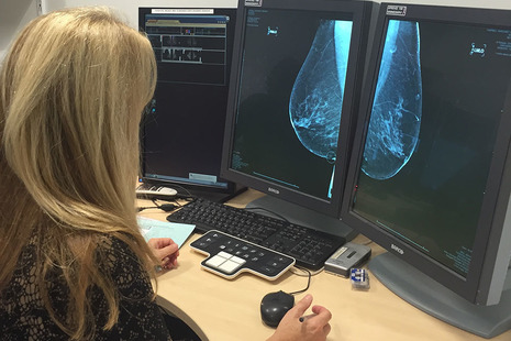 Woman in office looking at mammogram images on 2 computer screens.