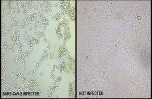 Comparison of cells with and without infection of the SARS-CoV-2 virus