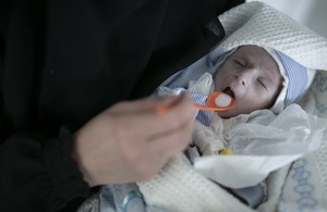 A baby suffering from malnutrition is fed by his mother in a hospital in Sana’a, Yemen. Picture: UNICEF