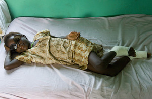Image of Sadia recovering from daily treatments for the painful Guinea worms emerging from her feet. Picture credit The Carter Center
