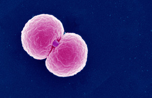 Electron micrograph image of gonococcus