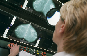 Breast x-ray