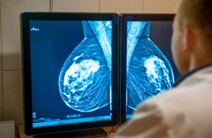An image of a medical professional examining a scan of someone's breast on a screen.