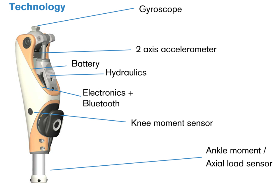 A view inside the Genium bionic prosthetic system 