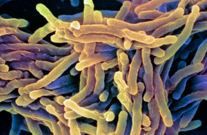tuberculosis pathogen