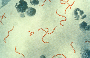 Streptococcus pyogenes