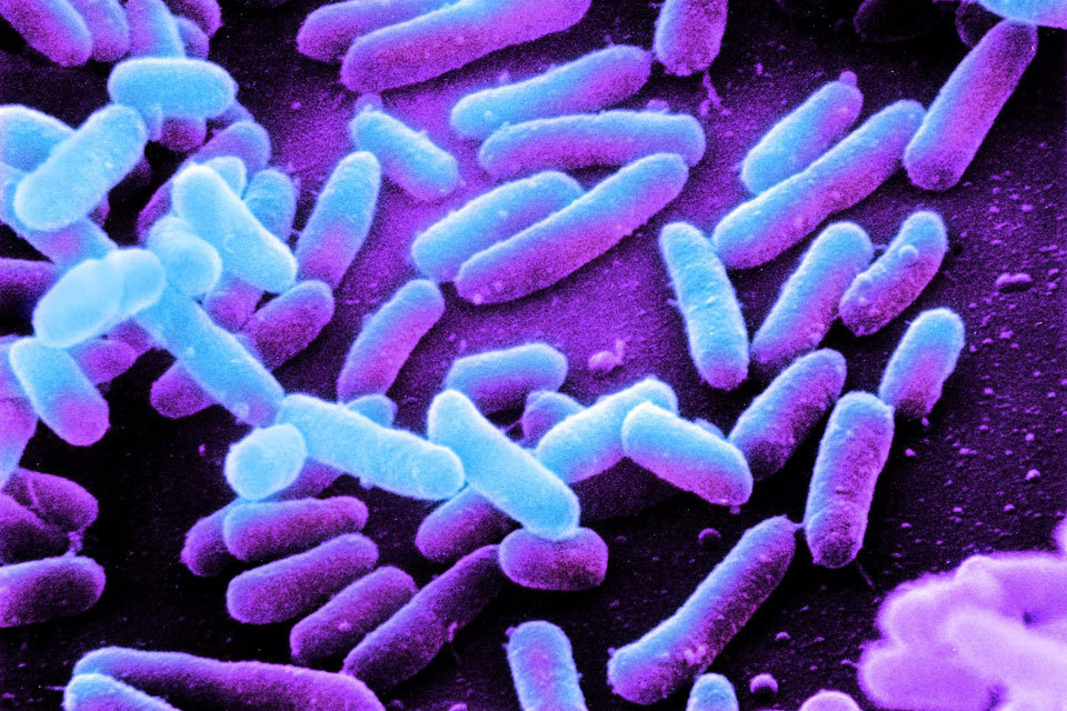 [Withdrawn] PHE investigating national outbreak of E. coli - GOV.UK