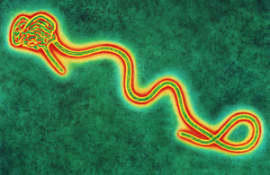 Ebola virus image.