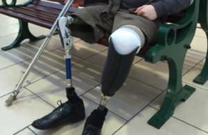 ProsFit: Picture showing a prosthetic leg.