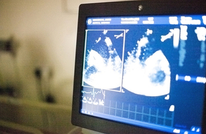 Heart monitor at UCLH