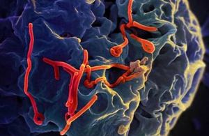 Ebola virus particle red vero cell blue-grey