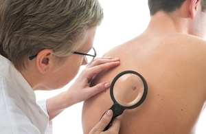 Patients with advanced melanoma are among the first in the world to access Pembrolizumab