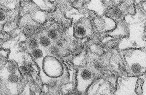 Zika virus, image courtesy US CDC