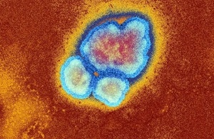 Increase in measles cases since February prompts call.