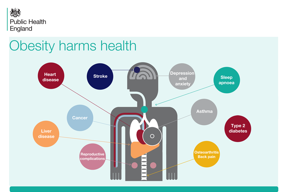 essay on public health issues obesity