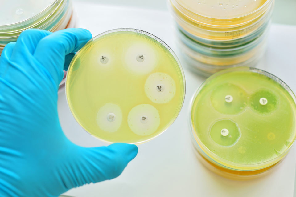 Tackling drug-resistant infection: apply for funding support - GOV.UK