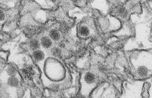 Zika infected cells