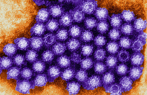Norovirus under a microscope