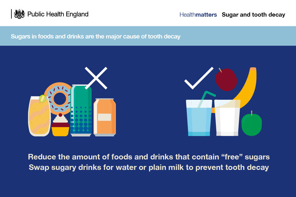 Infographic illustrating that sugars in foods and drinks are the major cause of tooth decay