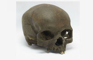 Human skull missing lower jawbone against white background