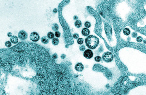 Lassa fever virus