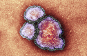 Measles virus particles