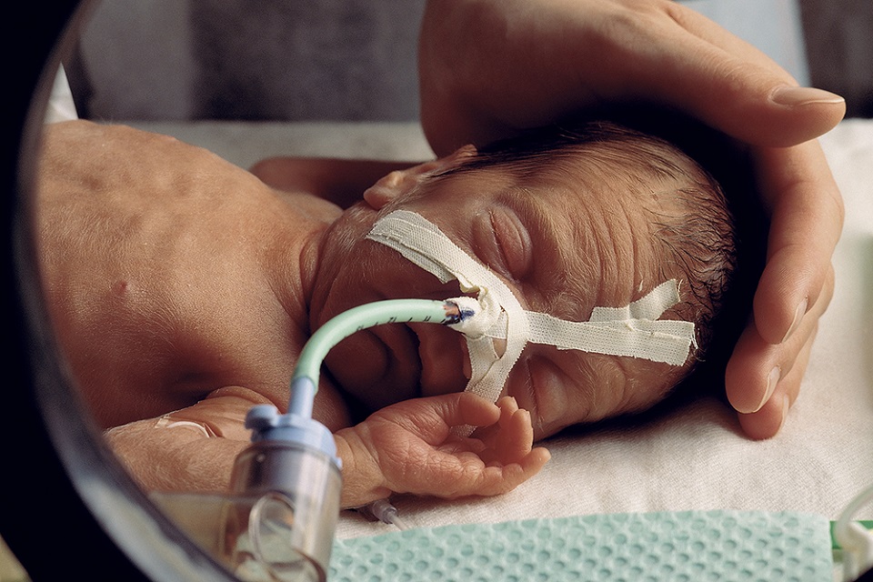 Baby in intensive care