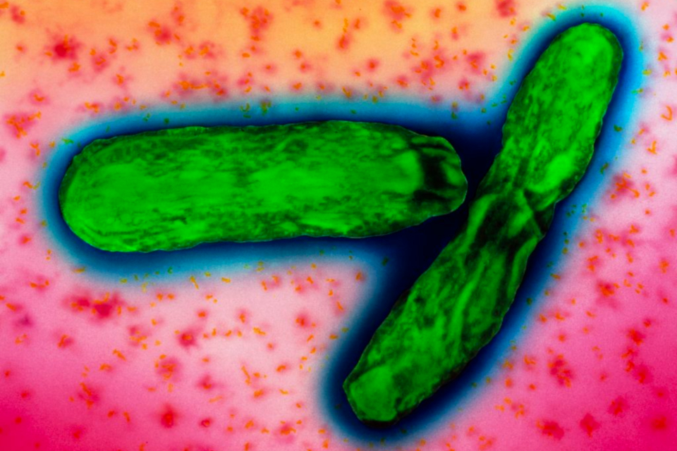 Transmission electron micrograph image of a mycobacterium tuberculosis