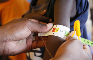 A child arm's circumference is checked during a malnutrition screening programme, at a health clinic in Turkana County, northwest Kenya.