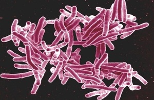 Visual representation of the TB genetic code