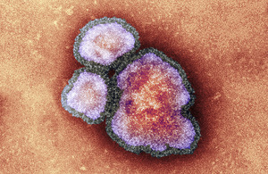 Measles virus particles