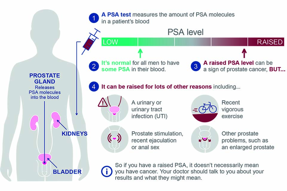 Advising Well Men About The Psa Test For Prostate Cancer Information 1887