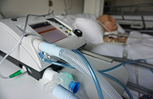 Patient on a ventilator.