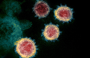Microscope image of a coronavirus