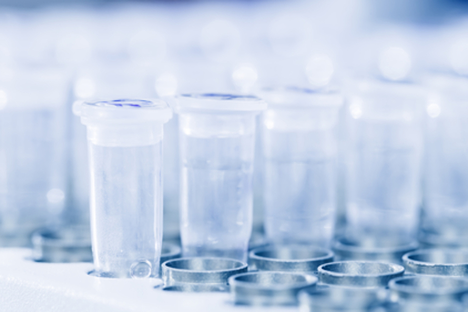 UK company delivers over 40,000 PCR test kits to Egypt
