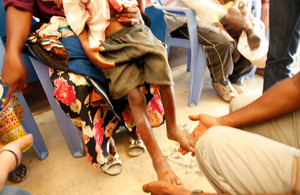 A boy is checked for signs of malnutrition in the local hospital, Masi Manimba, DRC. Picture: Russell Watkins/Department for International Development